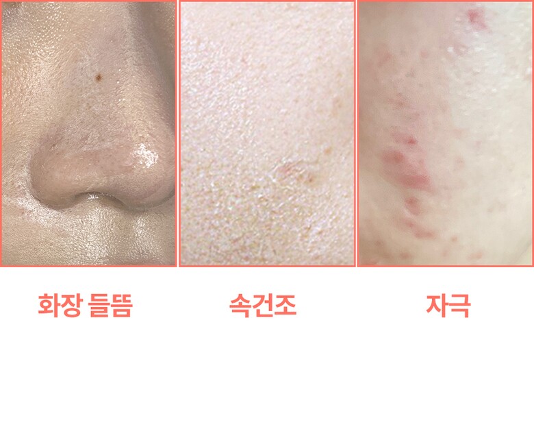 z_peeling_page_11.jpg