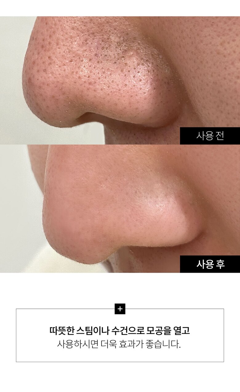 beautysuction_page_15.jpg